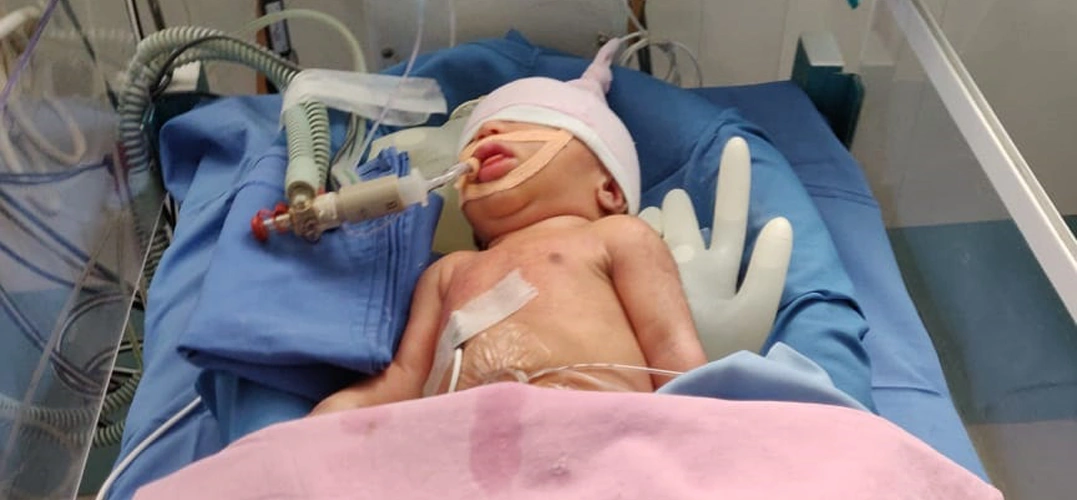 Neonatology Services 2