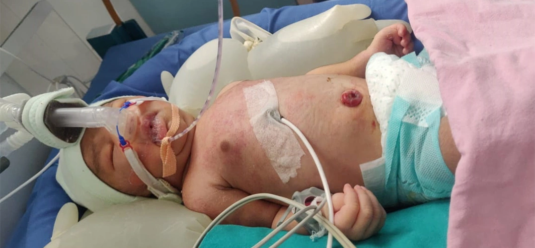 Neonatology Services 6